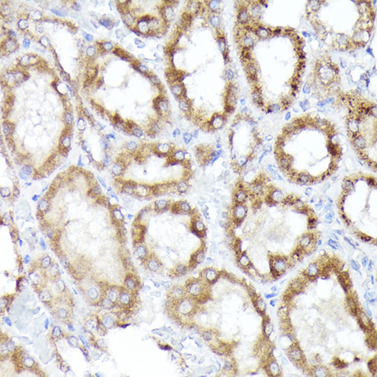 Immunohistochemistry - Anti-BNIP3L/NIX Antibody (A15147) - Antibodies.com