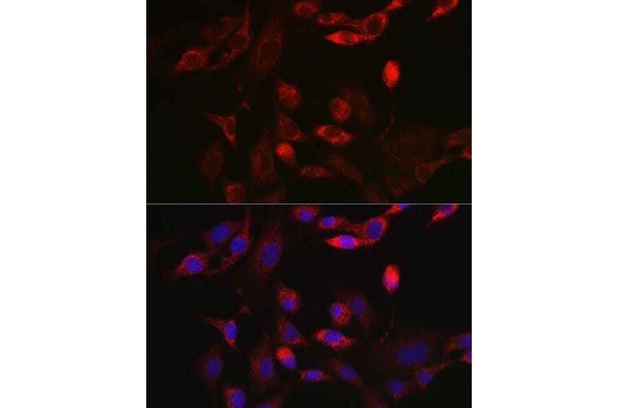 Immunofluorescence - Anti-BNIP3L/NIX Antibody (A15147) - Antibodies.com