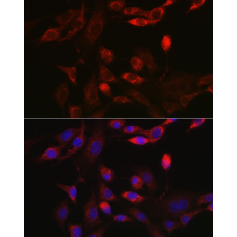 Immunofluorescence - Anti-BNIP3L/NIX Antibody (A15147) - Antibodies.com