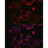 Immunofluorescence - Anti-BNIP3L/NIX Antibody (A15147) - Antibodies.com