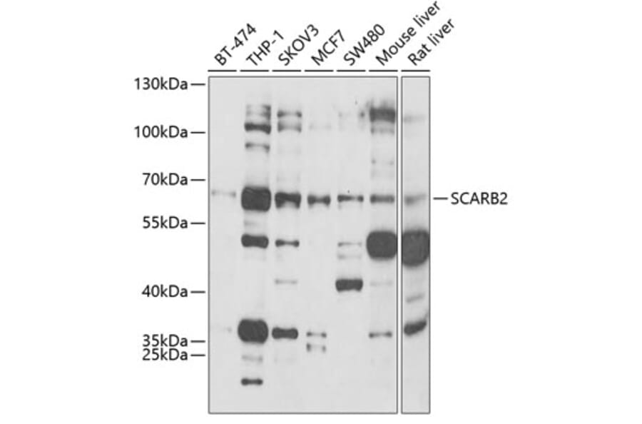 Western Blot - Anti-SCARB2 Antibody (A6285) - Antibodies.com