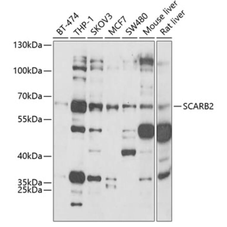 Western Blot - Anti-SCARB2 Antibody (A6285) - Antibodies.com