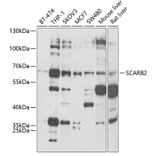 Western Blot - Anti-SCARB2 Antibody (A6285) - Antibodies.com