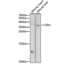 Western Blot - Anti-CISH Antibody (A6286) - Antibodies.com