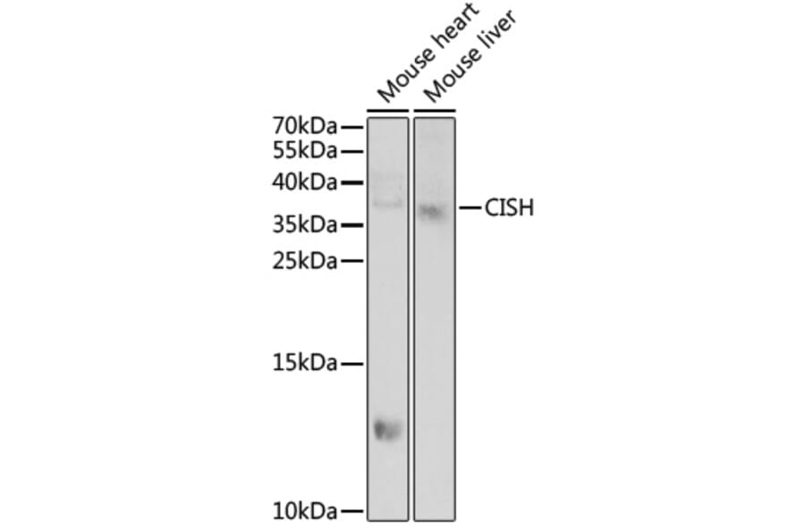 Western Blot - Anti-CISH Antibody (A6286) - Antibodies.com