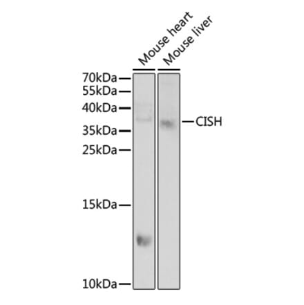 Western Blot - Anti-CISH Antibody (A15149) - Antibodies.com