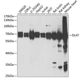 Western Blot - Anti-Pyruvate Dehydrogenase E2 Antibody (A15150) - Antibodies.com