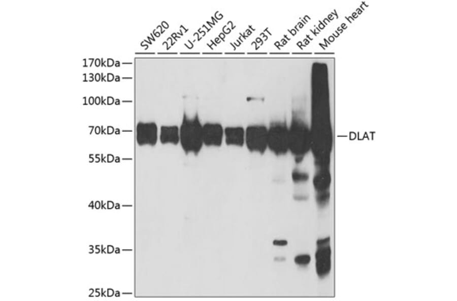 Western Blot - Anti-Pyruvate Dehydrogenase E2 Antibody (A15150) - Antibodies.com