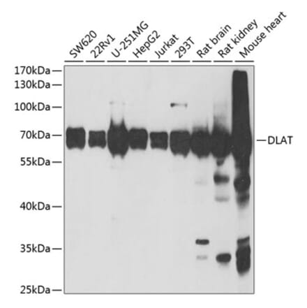 Western Blot - Anti-Pyruvate Dehydrogenase E2 Antibody (A15150) - Antibodies.com