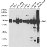 Western Blot - Anti-Pyruvate Dehydrogenase E2 Antibody (A15150) - Antibodies.com