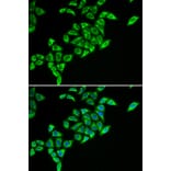 Immunofluorescence - Anti-Pyruvate Dehydrogenase E2 Antibody (A15150) - Antibodies.com