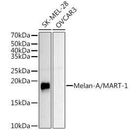 Western Blot - Anti-Melanoma Antibody (A15151) - Antibodies.com