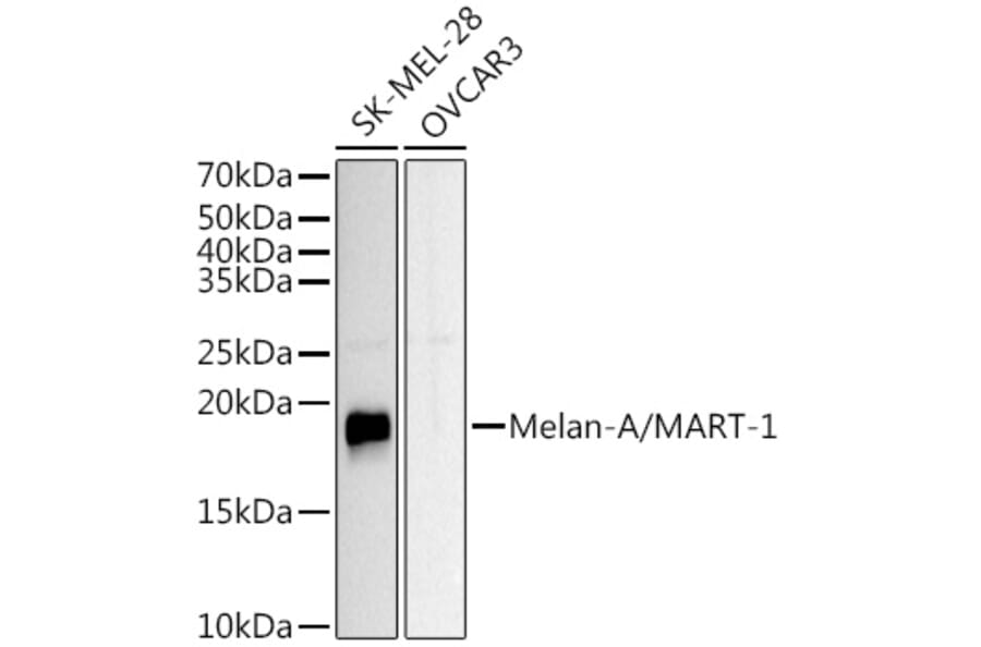 Western Blot - Anti-Melanoma Antibody (A15151) - Antibodies.com