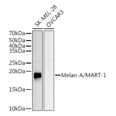Western Blot - Anti-Melanoma Antibody (A15151) - Antibodies.com