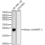 Western Blot - Anti-Melanoma Antibody (A15151) - Antibodies.com