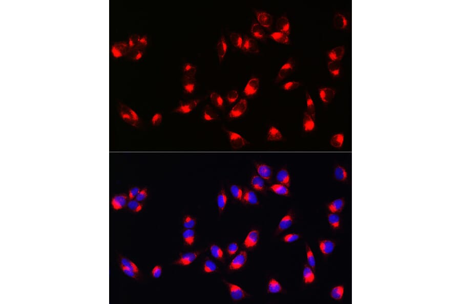 Immunofluorescence - Anti-Melanoma Antibody (A15151) - Antibodies.com