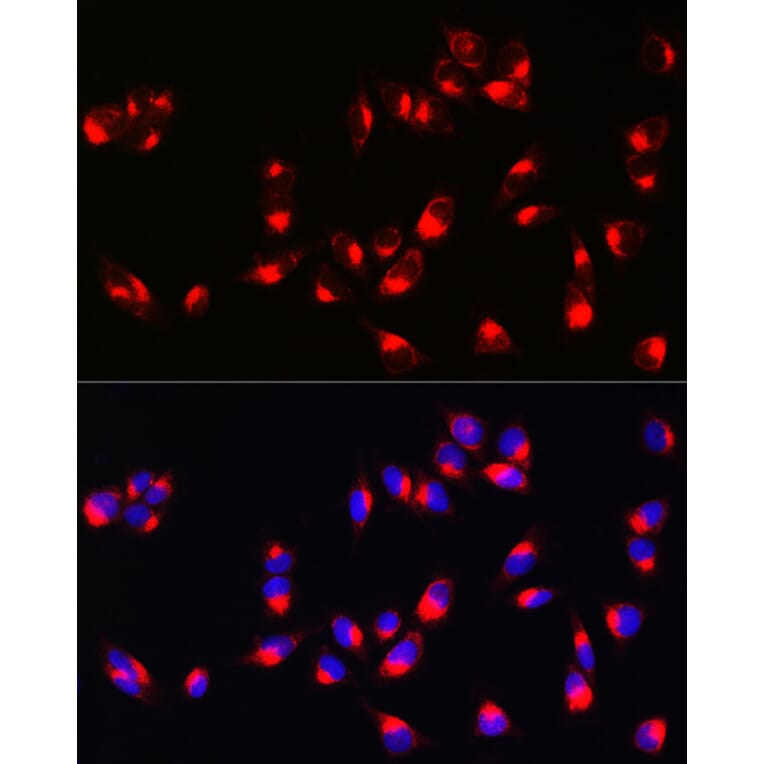 Immunofluorescence - Anti-Melanoma Antibody (A15151) - Antibodies.com