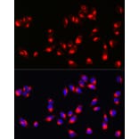 Immunofluorescence - Anti-Melanoma Antibody (A15151) - Antibodies.com