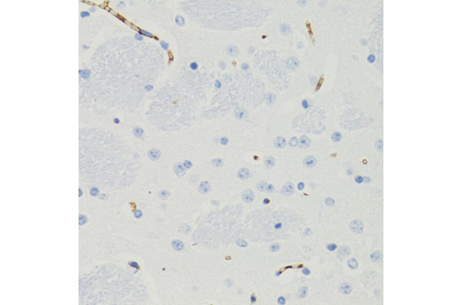 Immunohistochemistry - Anti-GALT Antibody (A6292) - Antibodies.com