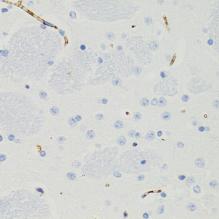 Immunohistochemistry - Anti-GALT Antibody (A6292) - Antibodies.com