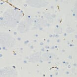 Immunohistochemistry - Anti-GALT Antibody (A6292) - Antibodies.com