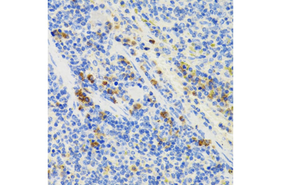 Immunohistochemistry - Anti-GALT Antibody (A6292) - Antibodies.com
