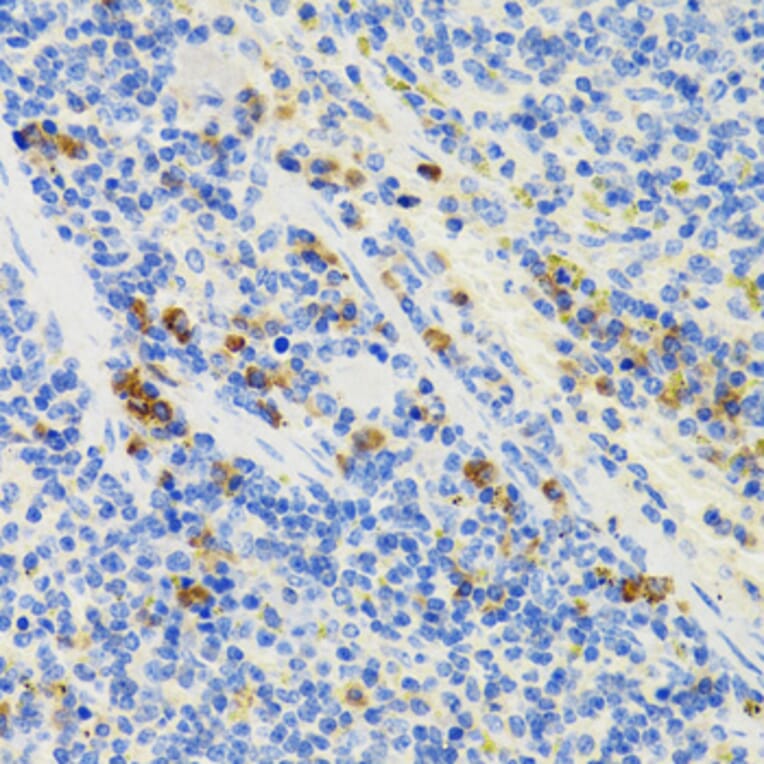 Immunohistochemistry - Anti-GALT Antibody (A6292) - Antibodies.com