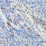 Immunohistochemistry - Anti-GALT Antibody (A6292) - Antibodies.com