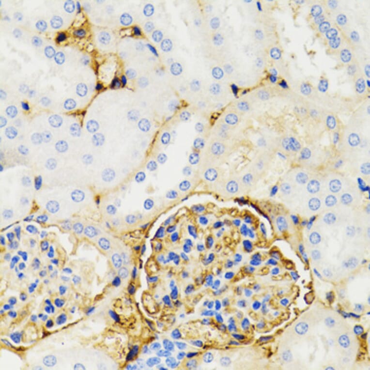 Immunohistochemistry - Anti-GALT Antibody (A6292) - Antibodies.com