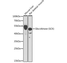 Western Blot - Anti-Glucokinase Antibody (A15153) - Antibodies.com