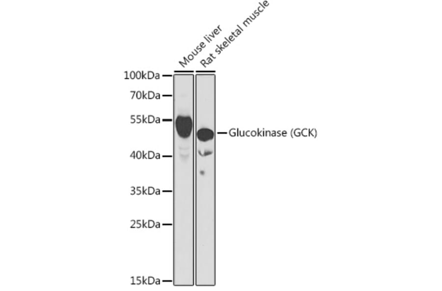 Western Blot - Anti-Glucokinase Antibody (A15153) - Antibodies.com