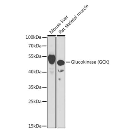 Western Blot - Anti-Glucokinase Antibody (A15153) - Antibodies.com