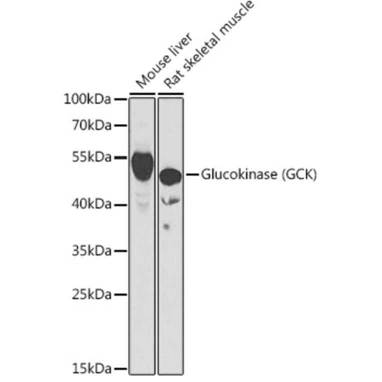 Western Blot - Anti-Glucokinase Antibody (A15153) - Antibodies.com