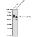 Western Blot - Anti-Glucokinase Antibody (A15153) - Antibodies.com