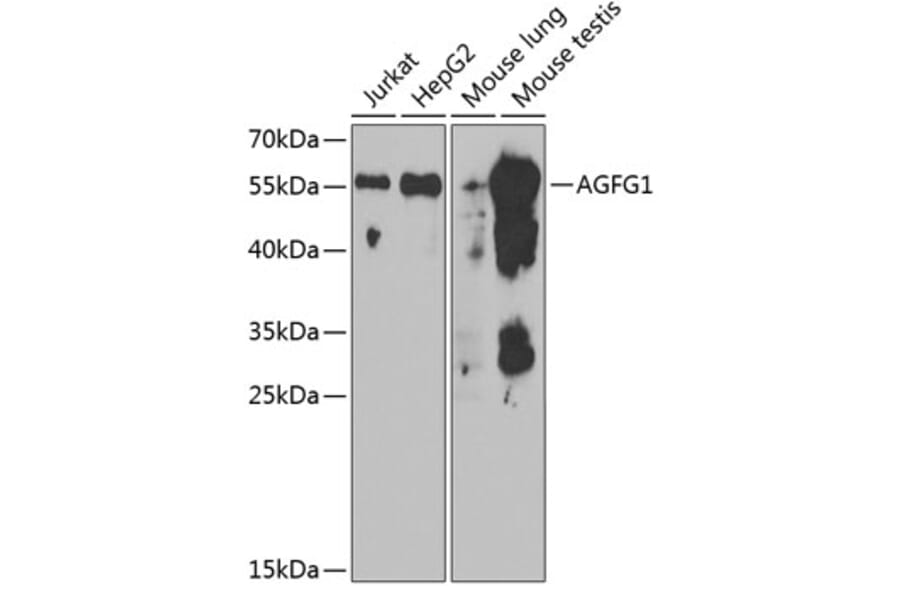 Western Blot - Anti-RAB Antibody (A15154) - Antibodies.com