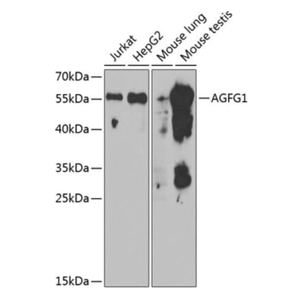 Western Blot - Anti-RAB Antibody (A15154) - Antibodies.com