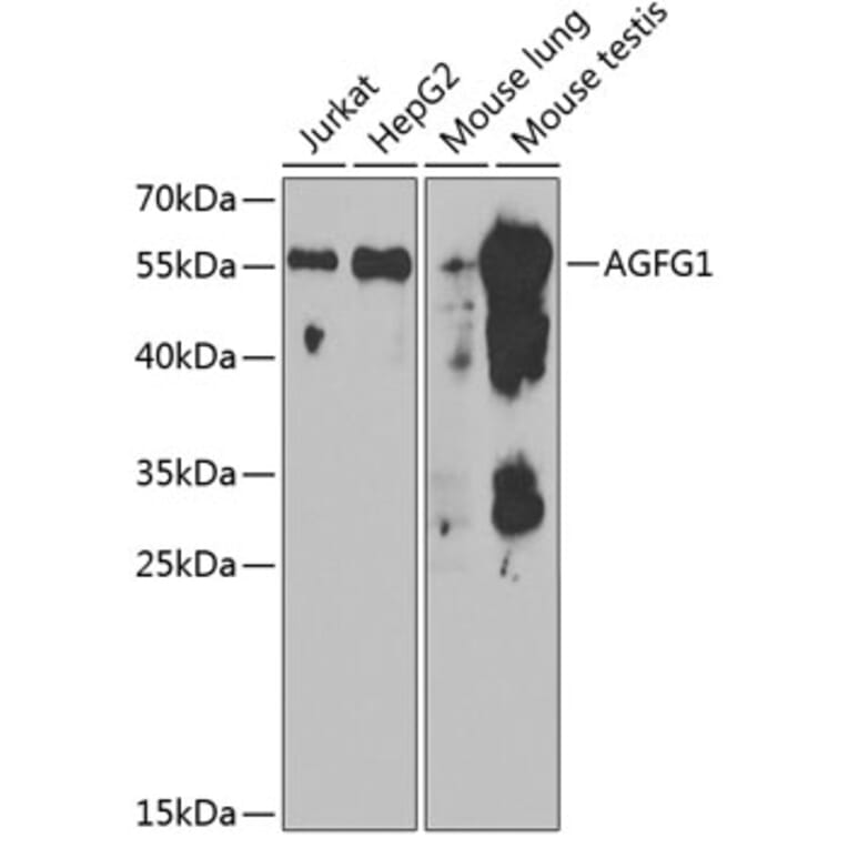 Western Blot - Anti-RAB Antibody (A15154) - Antibodies.com