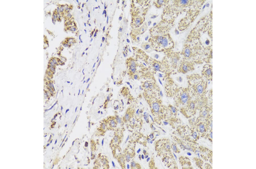 Immunohistochemistry - Anti-MDH2 Antibody (A6297) - Antibodies.com