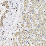 Immunohistochemistry - Anti-MDH2 Antibody (A6297) - Antibodies.com