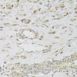 Immunohistochemistry - Anti-MDH2 Antibody (A6297) - Antibodies.com