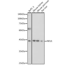 Western Blot - Anti-Neuraminidase Antibody (A15156) - Antibodies.com