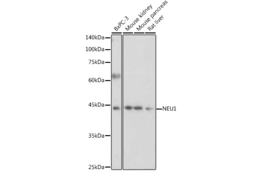 Western Blot - Anti-Neuraminidase Antibody (A15156) - Antibodies.com