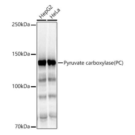 Western Blot - Anti-PCB Antibody (A15157) - Antibodies.com