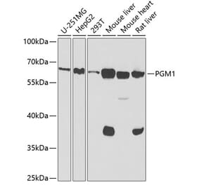 Western Blot - Anti-PGM1 Antibody (A15158) - Antibodies.com