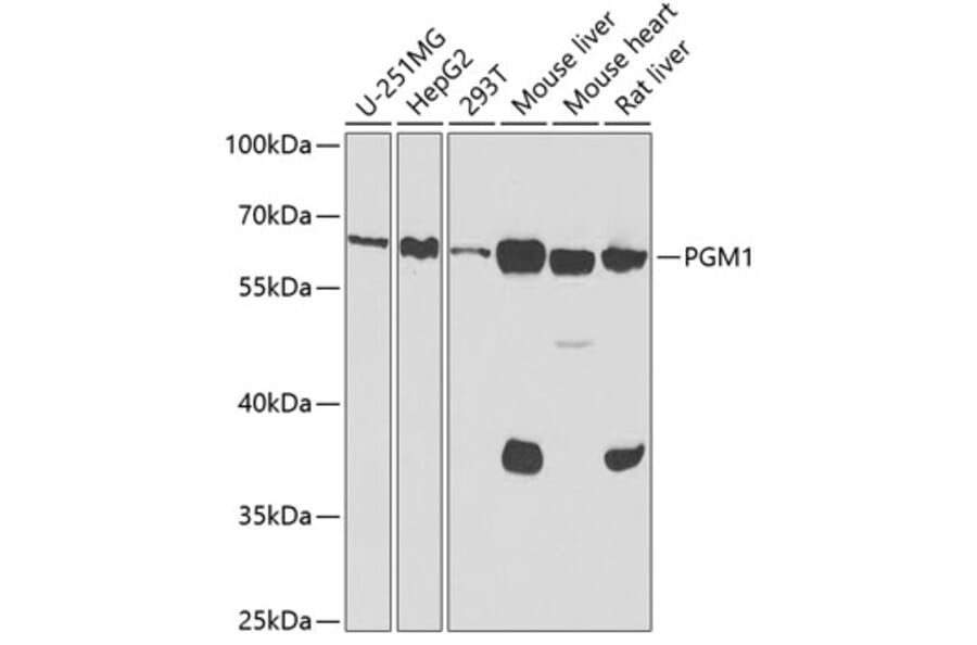 Western Blot - Anti-PGM1 Antibody (A15158) - Antibodies.com