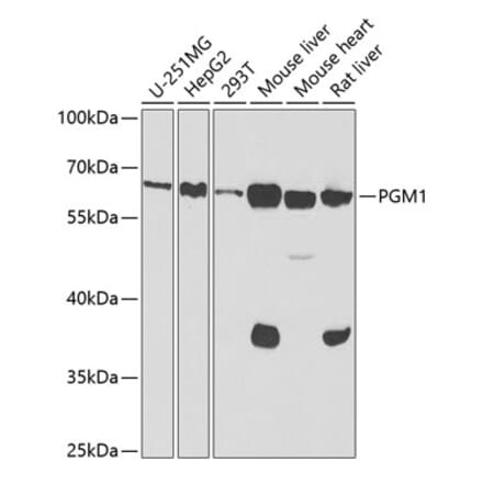 Western Blot - Anti-PGM1 Antibody (A15158) - Antibodies.com