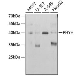 Western Blot - Anti-PHYH Antibody (A15159) - Antibodies.com