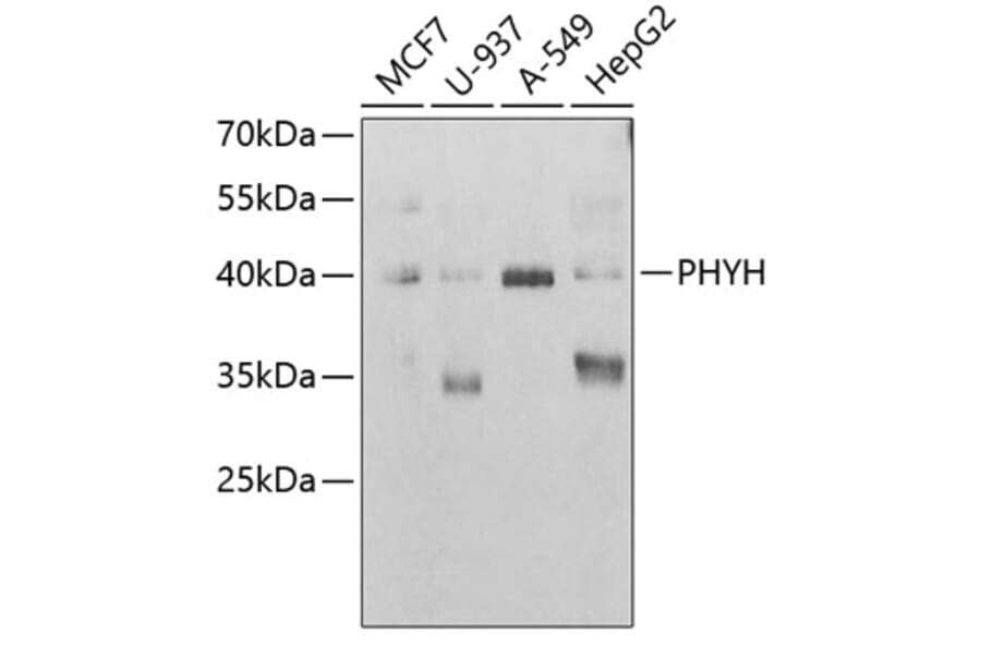Western Blot - Anti-PHYH Antibody (A15159) - Antibodies.com