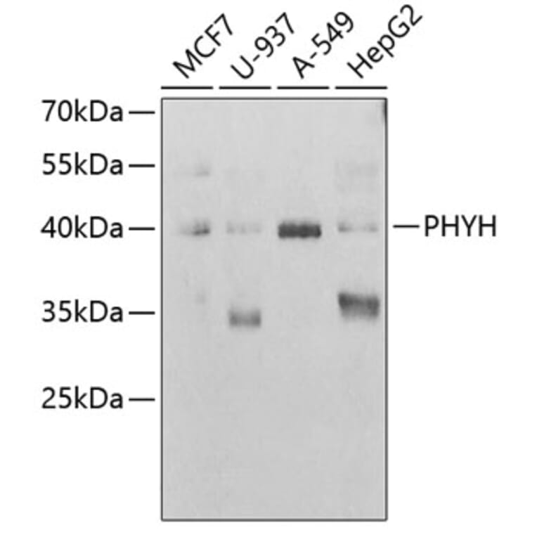 Western Blot - Anti-PHYH Antibody (A15159) - Antibodies.com