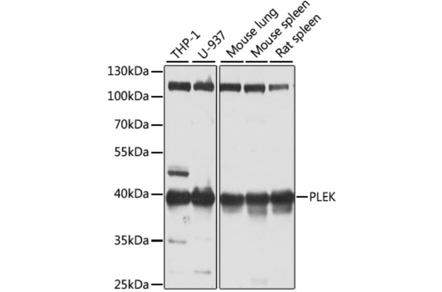 Western Blot - Anti-Pleckstrin Antibody (A15160) - Antibodies.com